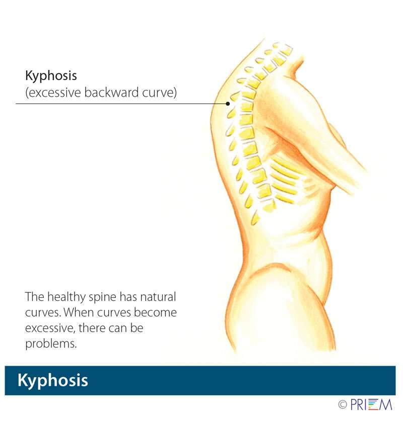 rounded spine diagram