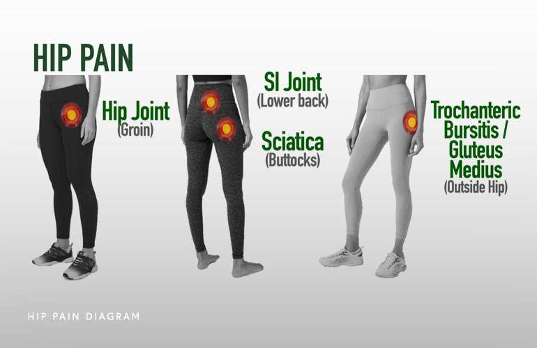 Hip-Pain-Diagram.jpg