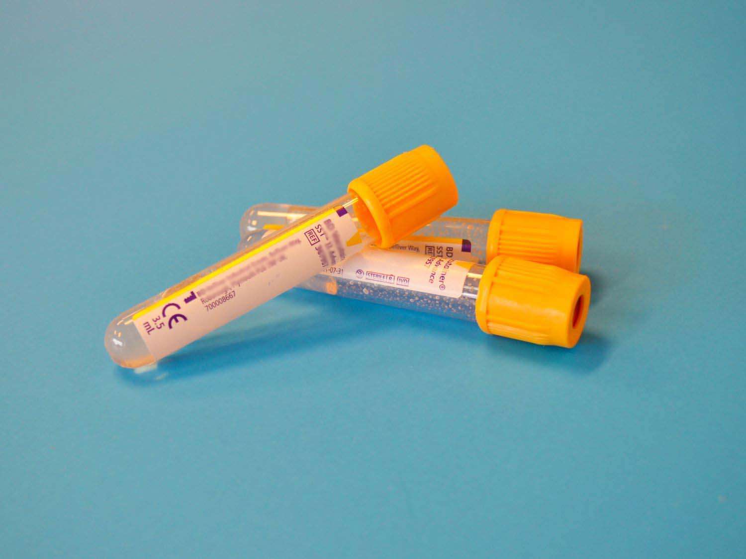 Blood samples for syphilis screening and testing